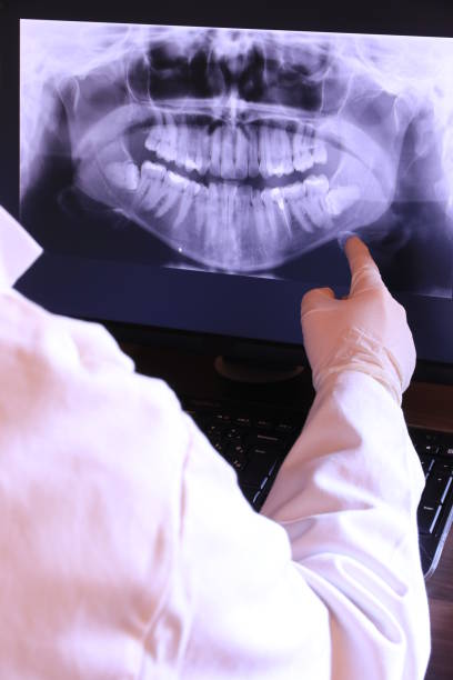 Best Emergency Root Canal Treatment in Friday Harbor, WA