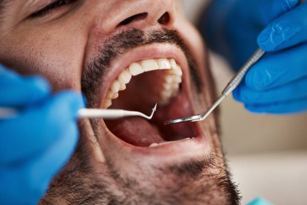 Best Emergency Treatment for Dental Infections or Abscesses in Friday Harbor, WA